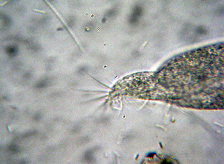 Protozoi marini: Trachelostyla pediculiformis ?